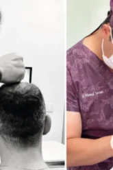5 reasons to choose a hair transplant turkey