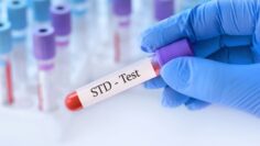 cheap-std-test-singapore