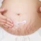 how to treat and prevent stretch marks (1)