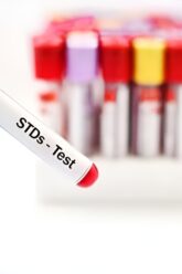 std-testing-and-treatment (1)