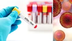 std-testing-and-treatment (1)
