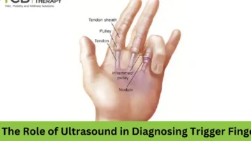 the role of ultrasound in diagnosing trigger finger