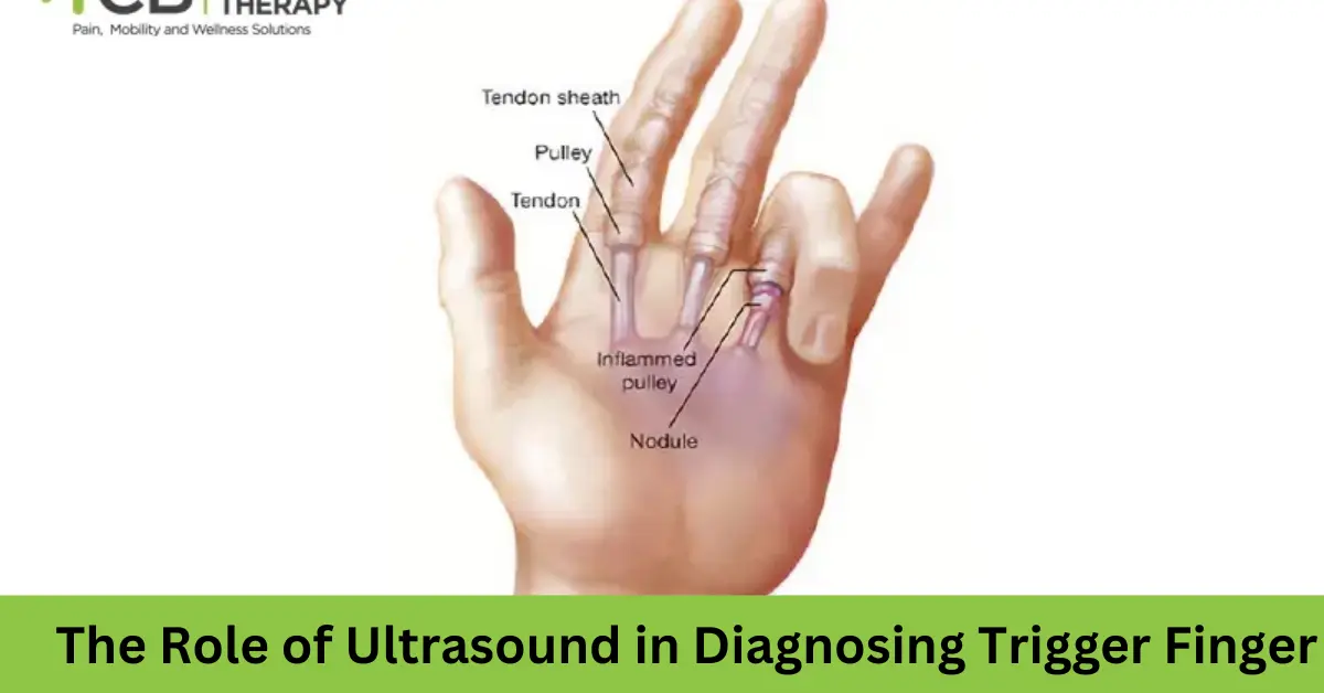 the role of ultrasound in diagnosing trigger finger